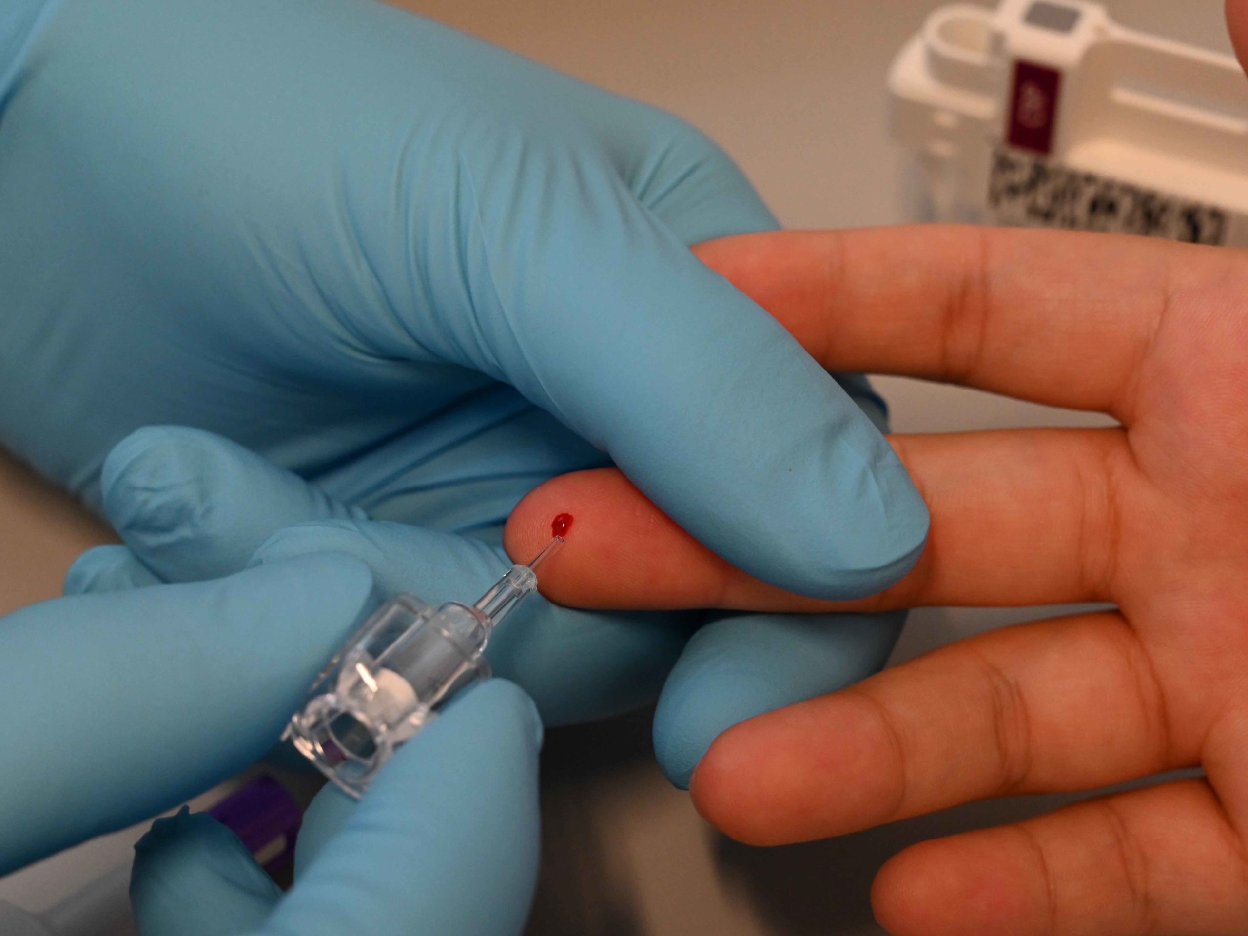 Ein kleiner Tropfen Blut genügt für den CRP Test in der Apotheke.